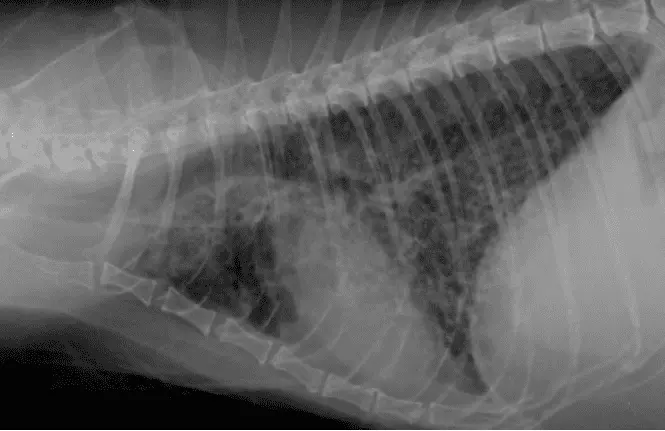 radiografia de pulmon imagen de ferrocarril - Cómo se ven los pulmones dañados en una radiografía